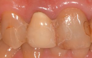 Blog 桶川の歯医者 アズ歯科 桶川医院 家族で通える優しい歯医者